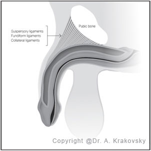 Penis Lengthening Surgery Part One